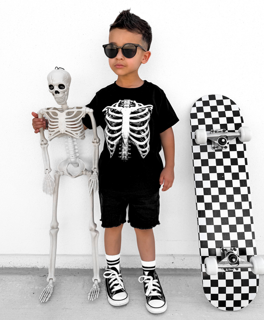 X-Ray